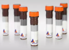 Consumables Antibody binding strength Antibody binding affinity Binding strength of the antibody Affinity of antibody binding Binding strength of antibodies Strength of antigen-antibody binding Affinity constant Binding kinetics Association rate Dissociation rate Affinity determination Avidity KD value Liganden-Bindungs-Assays DMPK-Analytik